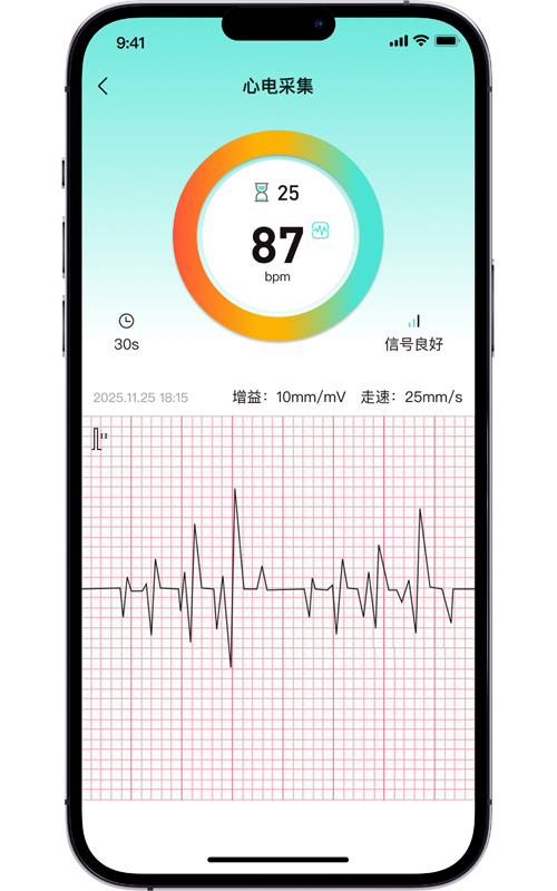 心电图记录<br>心电波动采集记录。